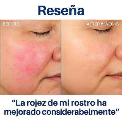 Hydroluxe: Ducha de Alta Presión y Filtr - Imagen 6